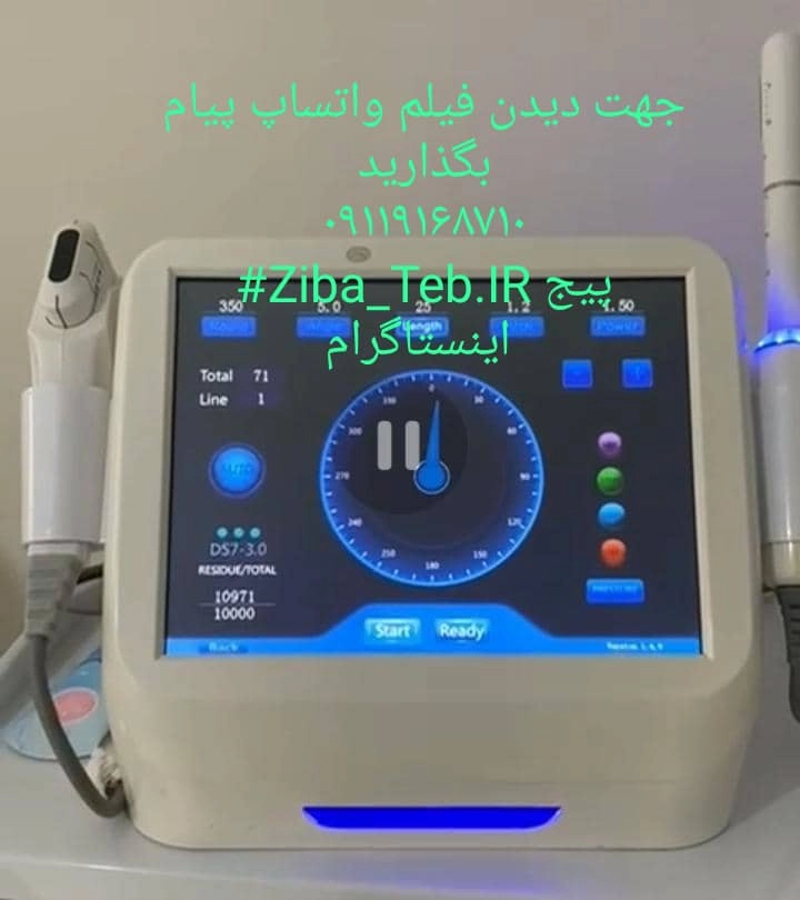 هایفو دلتا دو بعدی دستدوم