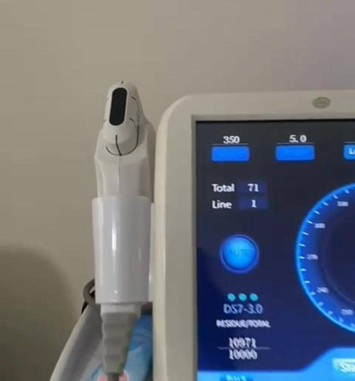 هایفوجوانسازی